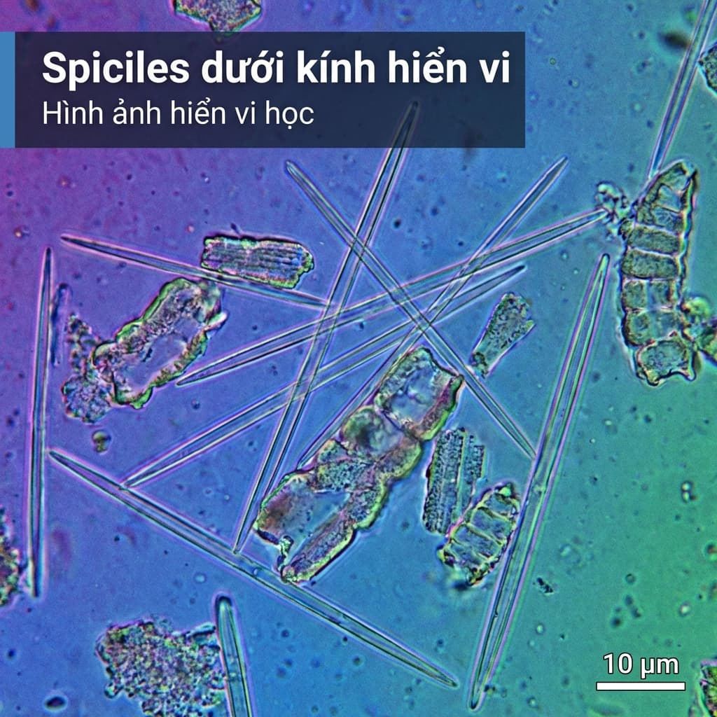 Spicules Là Gì? Sự Thật Về Cấy Tảo Sinh Học (Algae Peel)