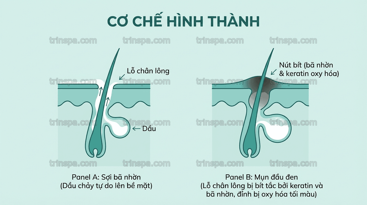 Sơ đồ cấu trúc sợi bã nhờn