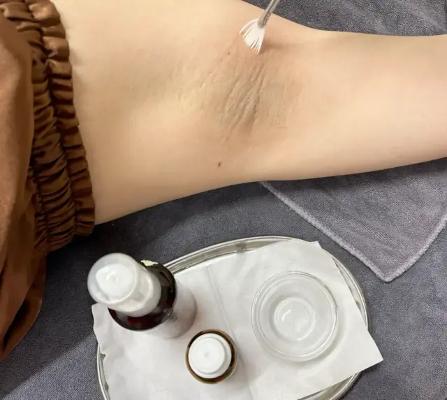 Peeling trị thâm nách tại TriN Spa — thoa axit lactic bằng cọ chuyên dụng